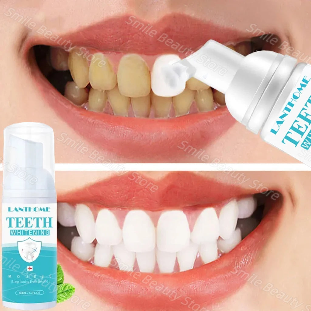 Teeth Whitening Mousse