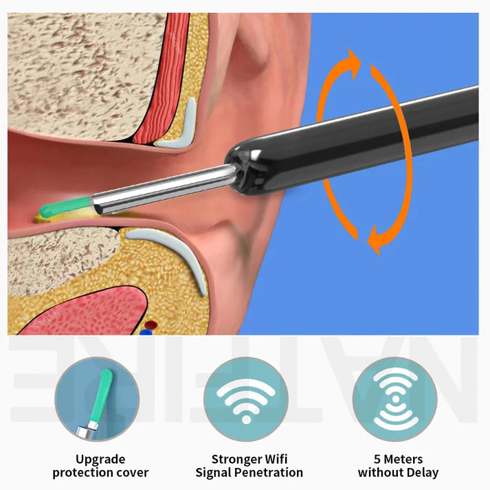 Wireless Visual Ear Wax Cleaner with HD Camera