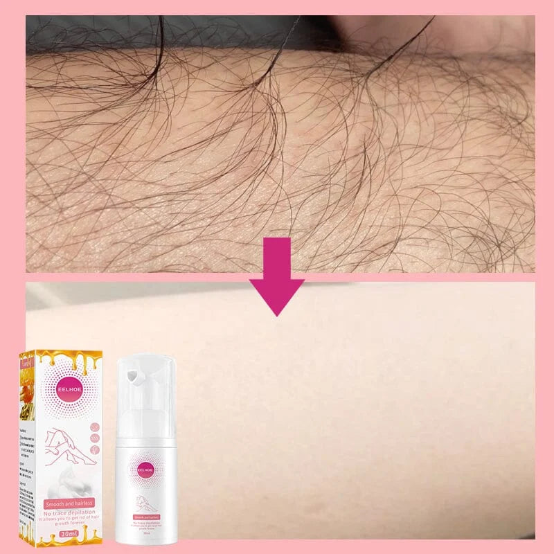 Hair Removal Spray