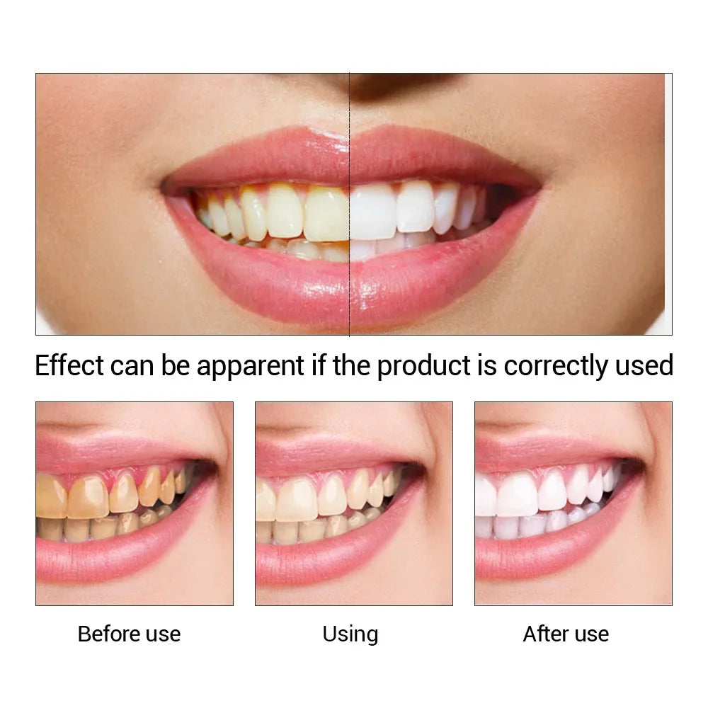 Teeth Whitening Mousse