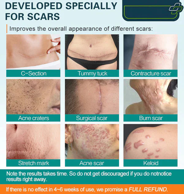 ScarRemove™ Advanced Scar Spray