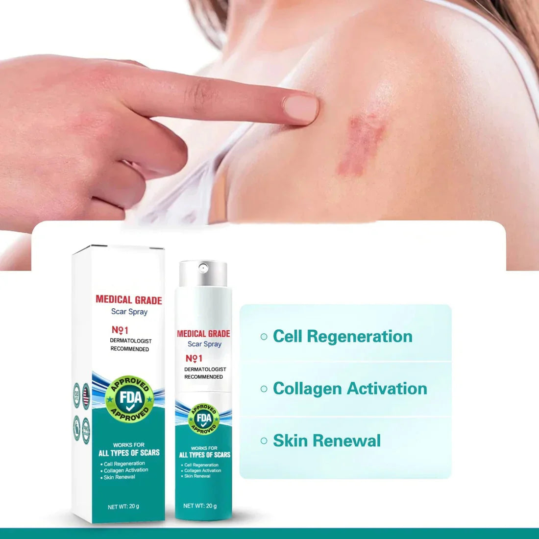 ScarRemove™ Advanced Scar Spray