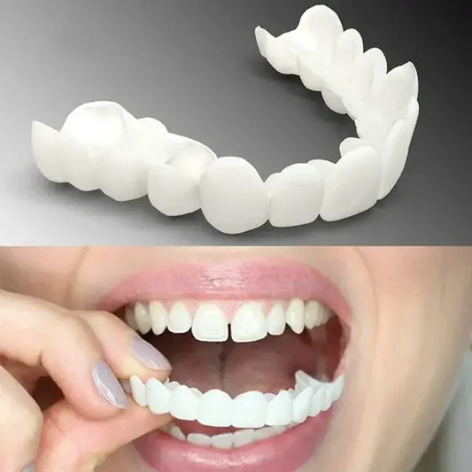 Adjustable Snap-On Dentures